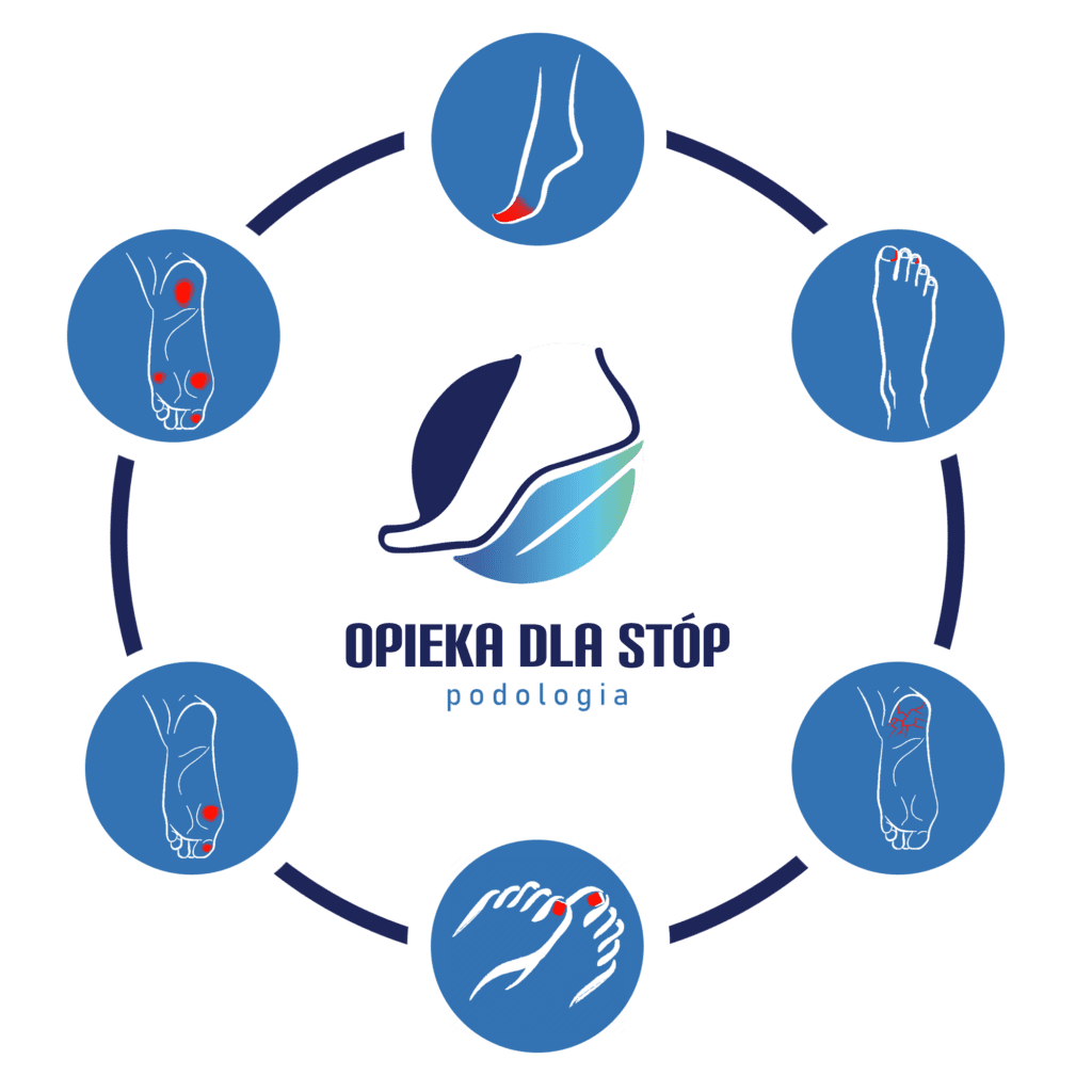 Opieka Dla Stóp