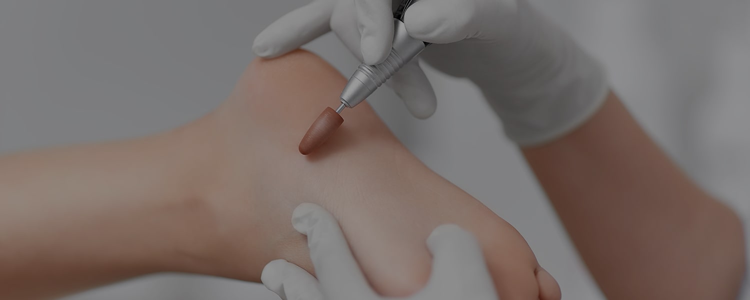 Opieka Dla Stóp-O Mnie